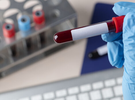 Surgeon Holding A Blood Test