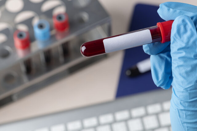 NHS Blood Test Data Breach in London: What You Need to Know